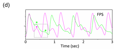   
		Figure 1d: Epidermal pulse signals before (green) and after (magenta) exercise of a human subject	 
